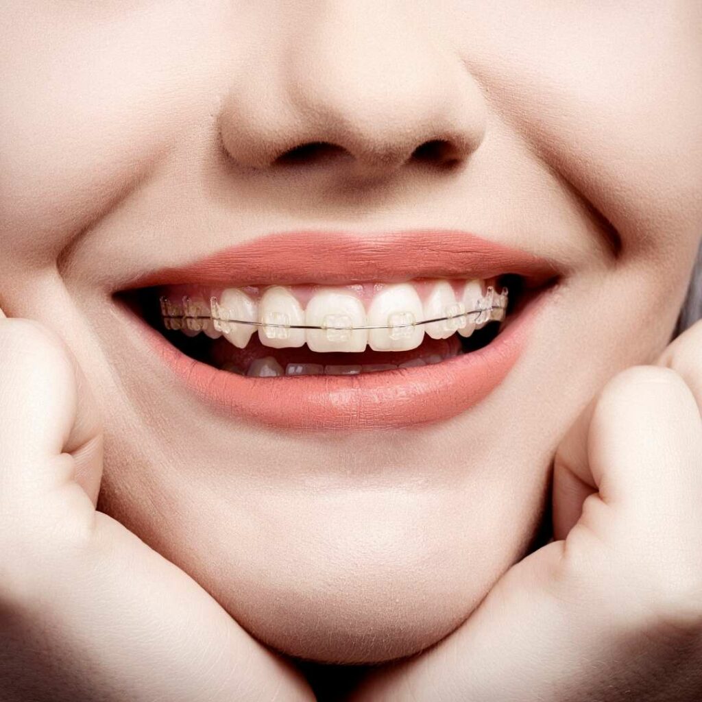 What is Orthodontics