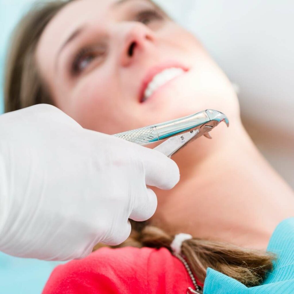Teeth Extraction FAQ