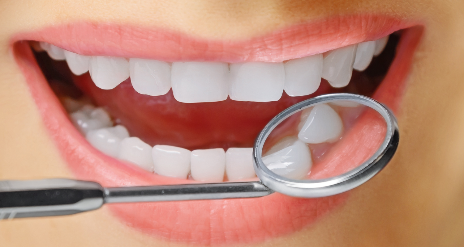 choose your dental implant
