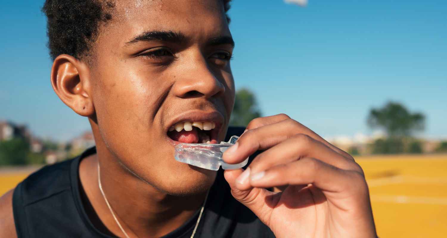 Mouthguards