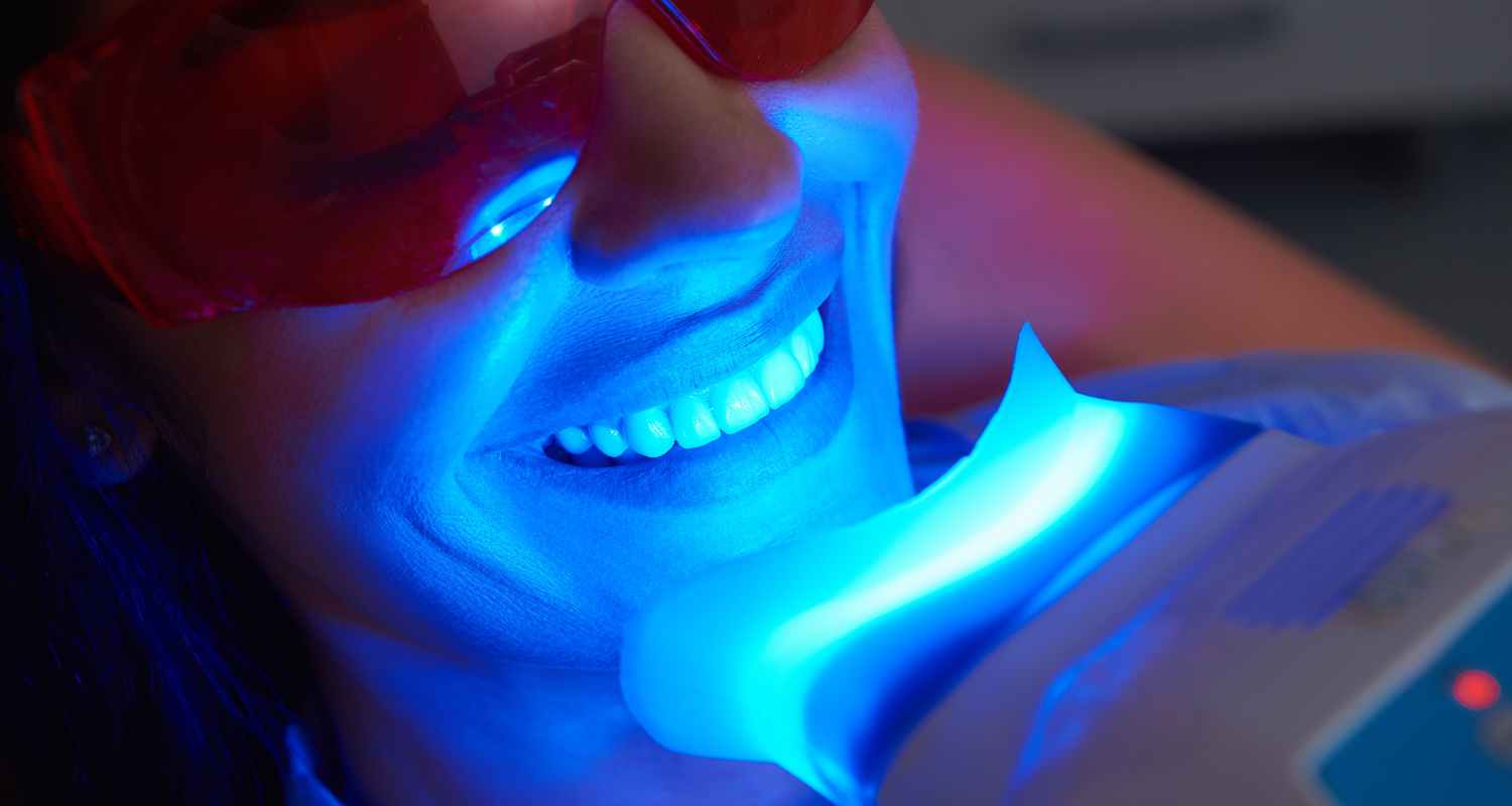 Teeth Whitening in Saint John