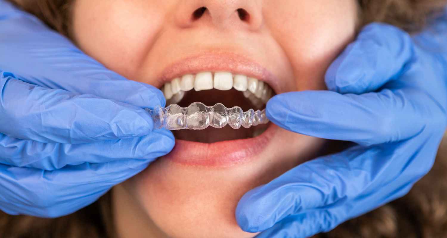 Invisalign